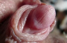 Clitoris